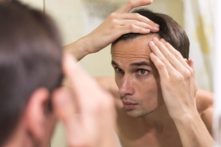 Hair fall in men